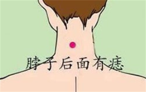 脖子有痣的男人好不好 脖子有痣的男人怎么样