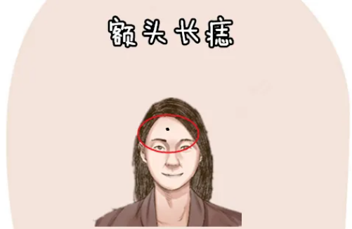 额头痣女人面相图解 额头有痣的人是什么命