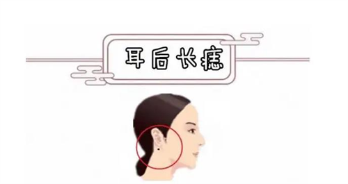 耳后有痣的女人好吗 耳后有痣的女人代表什么