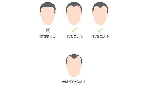 美人尖很稀有吗 男人美人尖很稀有吗